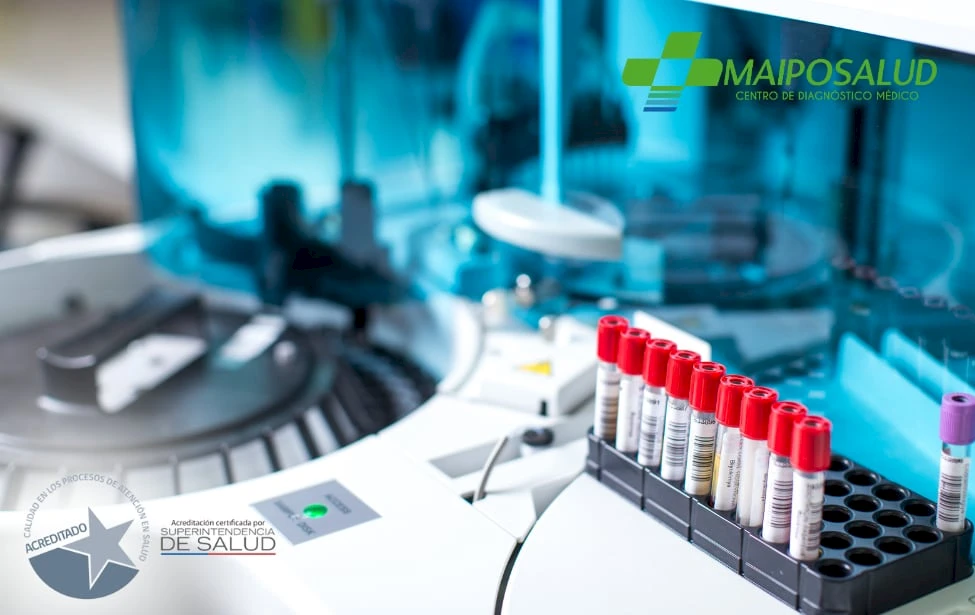 Tubos con muestras de sangre